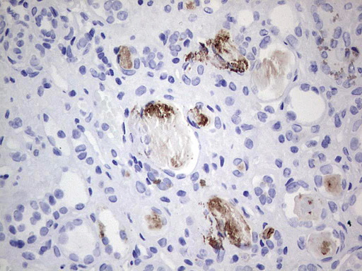 MMP7 / Matrilysin Antibody - Immunohistochemical staining of paraffin-embedded Human Kidney tissue within the normal limits using anti-MMP7 mouse monoclonal antibody. (Heat-induced epitope retrieval by 1 mM EDTA in 10mM Tris, pH8.5, 120C for 3min,