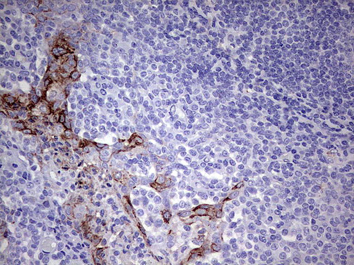 MMP7 / Matrilysin Antibody - Immunohistochemical staining of paraffin-embedded Human tonsil using anti-MMP7 mouse monoclonal antibody.  heat-induced epitope retrieval by 1 mM EDTA in 10mM Tris, pH8.0, 120C for 3min)