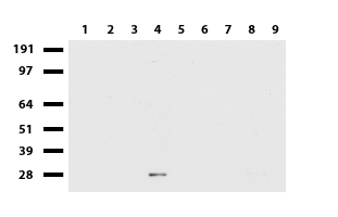 MMP7 / Matrilysin Antibody - Western blot of cell lysates. (35ug) from 9 different cell lines. (1: HepG2, 2: HeLa, 3: SV-T2, 4: A549, 5: COS7, 6: Jurkat, 7: PC-12, 8: MDCK, 9: MCF7). Diluation: 1:500