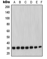MMP7 / Matrilysin Antibody - Western blot analysis of MMP7 expression in A431 (A); SW620 (B); COLO205 (C); LOVO (D); HT29 (E); A2780 (F); SKOV3 (G) whole cell lysates.