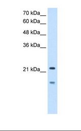 MMP7 / Matrilysin Antibody - HepG2 cell lysate. Antibody concentration: 2.5 ug/ml. Gel concentration: 12%.  This image was taken for the unconjugated form of this product. Other forms have not been tested.