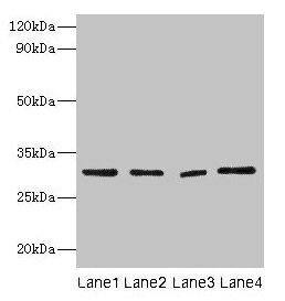 MMP7 / Matrilysin Antibody - Western blot All lanes: Matrilysin antibody at 2µg/ml Lane 1: Colo320 whole cell lysayeLane 2: NIH/3T3 whole cell lysayeLane 3: Mouse lung tissue Lane 4: HepG2 whole cell lysate Secondary Goat polyclonal to rabbit IgG at 1/10000 dilution Predicted band size: 30 kDa Observed band size: 30 kDa