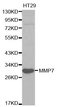 MMP7 / Matrilysin Antibody - Western blot analysis of extracts of HT-29 cells, using MMP7 antibody at 1:1000 dilution. The secondary antibody used was an HRP Goat Anti-Rabbit IgG (H+L) at 1:10000 dilution. Lysates were loaded 25ug per lane and 3% nonfat dry milk in TBST was used for blocking.