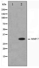 MMP7 / Matrilysin Antibody - Western blot of COS7 cell lysate using MMP7 Antibody