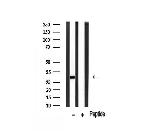 MMP7 / Matrilysin Antibody - Western blot analysis of MMP7 expression in mouse brain lysate