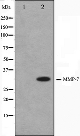 MMP7 / Matrilysin Antibody - Western blot analysis on COS7 cell lysates using MMP7 antibody. The lane on the left is treated with the antigen-specific peptide.