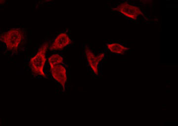 MMP7 / Matrilysin Antibody - Staining HeLa cells by IF/ICC. The samples were fixed with PFA and permeabilized in 0.1% Triton X-100, then blocked in 10% serum for 45 min at 25°C. The primary antibody was diluted at 1:200 and incubated with the sample for 1 hour at 37°C. An Alexa Fluor 594 conjugated goat anti-rabbit IgG (H+L) Ab, diluted at 1/600, was used as the secondary antibody.