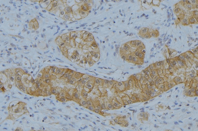 MMP7 / Matrilysin Antibody - 1:100 staining human uterus tissue by IHC-P. The sample was formaldehyde fixed and a heat mediated antigen retrieval step in citrate buffer was performed. The sample was then blocked and incubated with the antibody for 1.5 hours at 22°C. An HRP conjugated goat anti-rabbit antibody was used as the secondary.