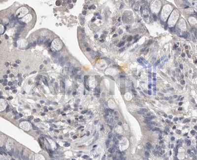 MMP7 / Matrilysin Antibody - IHC analysis of mouse colon tissue using MMP7 antibody at 1:100.