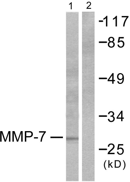 MMP7 / Matrilysin Antibody - Western blot analysis of extracts from COS7 cells, using MMP-7 antibody.