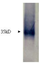 MMP7 / Matrilysin Antibody - Immunodetection Analysis: Representative blot from a previous lot. Lane 1.recombinant proteinMMP7. The membrane blot was probed with anti-MMP7 primary antibody(0.25?g/ml). Proteins werevisualized using a goat anti-rabbit secondary antibodyconjugated to HRP and chemiluminescence detectionsystem. Arrows indicate cellular MMP7 from humanand mouse cells (35 kDa).