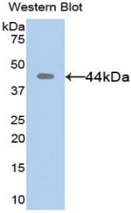 MMP8 Antibody - Western blot of recombinant MMP8 / MMP-8.  This image was taken for the unconjugated form of this product. Other forms have not been tested.