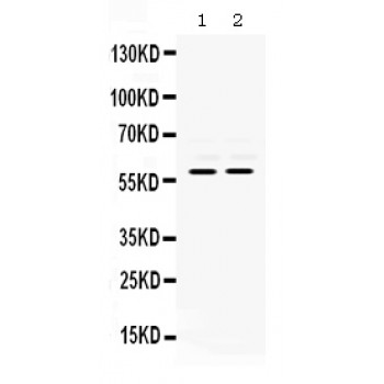 MMP8 Antibody - MMP8 antibody Western blot. All lanes: Anti MMP8 at 0.5 ug/ml. Lane 1: K562 Whole Cell Lysate at 40 ug. Lane 2: JURKAT Whole Cell Lysate at 40 ug. Predicted band size: 60 kD. Observed band size: 60 kD.