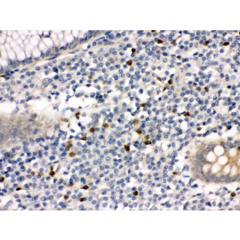 MMP8 Antibody - MMP8 antibody IHC-paraffin. IHC(P): Human Appendicitis Tissue.