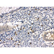 MMP8 Antibody - MMP8 antibody IHC-paraffin. IHC(P): Human Appendicitis Tissue.