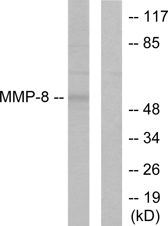 MMP8 Antibody - Western blot analysis of lysates from NIH/3T3 cells, using MMP-8 Antibody. The lane on the right is blocked with the synthesized peptide.