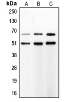 MMP8 Antibody - Western blot analysis of MMP8 expression in SJRH30 (A); PMNL (B); Sw620 (C) whole cell lysates.