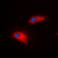 MMP8 Antibody - Immunofluorescent analysis of MMP8 staining in SW620 cells. Formalin-fixed cells were permeabilized with 0.1% Triton X-100 in TBS for 5-10 minutes and blocked with 3% BSA-PBS for 30 minutes at room temperature. Cells were probed with the primary antibody in 3% BSA-PBS and incubated overnight at 4 C in a humidified chamber. Cells were washed with PBST and incubated with a DyLight 594-conjugated secondary antibody (red) in PBS at room temperature in the dark. DAPI was used to stain the cell nuclei (blue).
