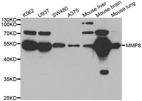 MMP8 Antibody - Western blot analysis of extracts of various cell lines.