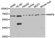 MMP8 Antibody - Western blot analysis of extracts of various cells.