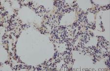 MMP8 Antibody - Immunohistochemistry of paraffin-embedded Rat lung using MMP8 Polyclonal Antibody at dilution of 1:50.
