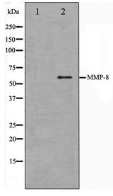 MMP8 Antibody - Western blot of NIH-3T3 cell lysate using MMP8 Antibody
