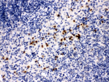 MMP8 Antibody