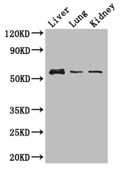 MMP8 Antibody - Positive WB detected in:Mouse liver tissue,Mouse lung tissue,Mouse kidney tissue;All lanes: MMP8 antibody at 3ug/ml;Secondary;Goat polyclonal to rabbit IgG at 1/50000 dilution;Predicted band size: 54 kDa;Observed band size: 54 kDa;