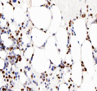 MMP8 Antibody - 1:100 staining human bone tissue by IHC-P. The tissue was formaldehyde fixed and a heat mediated antigen retrieval step in citrate buffer was performed. The tissue was then blocked and incubated with the antibody for 1.5 hours at 22 °C. An HRP conjugated goat anti-rabbit antibody was used as the secondary.