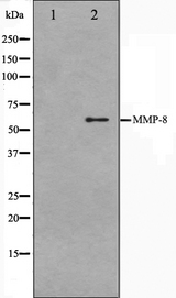 MMP8 Antibody - Western blot analysis on NIH-3T3 cell lysates using MMP8 antibody. The lane on the left is treated with the antigen-specific peptide.