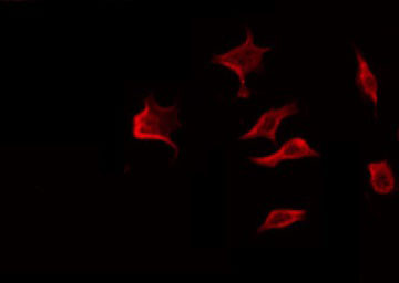 MMP8 Antibody - Staining NIH-3T3 cells by IF/ICC. The samples were fixed with PFA and permeabilized in 0.1% Triton X-100, then blocked in 10% serum for 45 min at 25°C. The primary antibody was diluted at 1:200 and incubated with the sample for 1 hour at 37°C. An Alexa Fluor 594 conjugated goat anti-rabbit IgG (H+L) Ab, diluted at 1/600, was used as the secondary antibody.