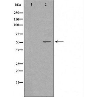MMP8 Antibody - Western blot analysis of MMP-8 expression in NIH-3T3 cells. The lane on the left is treated with the antigen-specific peptide.