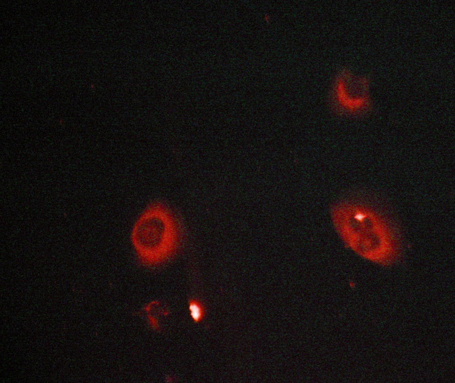 MMP8 Antibody - Staining LOVO cells by IF/ICC. The samples were fixed with PFA and permeabilized in 0.1% saponin prior to blocking in 10% serum for 45 min at 37°C. The primary antibody was diluted 1/400 and incubated with the sample for 1 hour at 37°C. A Alexa Fluor® 594 conjugated goat polyclonal to rabbit IgG (H+L), diluted 1/600 was used as secondary antibody.