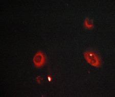 MMP8 Antibody - Staining LOVO cells by IF/ICC. The samples were fixed with PFA and permeabilized in 0.1% saponin prior to blocking in 10% serum for 45 min at 37°C. The primary antibody was diluted 1/400 and incubated with the sample for 1 hour at 37°C. A Alexa Fluor® 594 conjugated goat polyclonal to rabbit IgG (H+L), diluted 1/600 was used as secondary antibody.