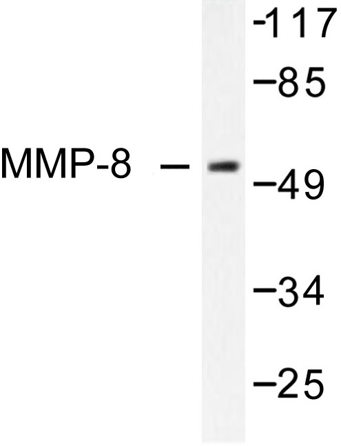 MMP8 Antibody - Western blot of MMP-8 (F445) pAb in extracts from NIH/3T3 cells.