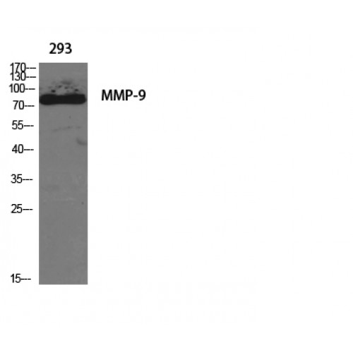 MMP9 / Gelatinase B Antibody - Western blot of MMP-9 antibody