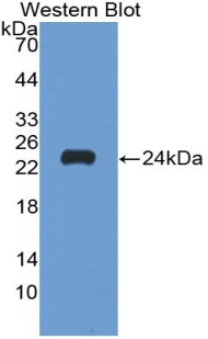 MMP9 / Gelatinase B Antibody - Western blot of recombinant MMP9 / Gelatinase B.