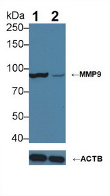 MMP9 / Gelatinase B Antibody - Knockout Varification: Lane 1: Wild-type HepG2 cell lysate; Lane 2: MMP9 knockout HepG2 cell lysate; Predicted MW: 76kDa Observed MW: 90kDa Primary Ab: 3µg/ml Mouse Anti-Human MMP9 Antibody Second Ab: 0.2µg/mL HRP-Linked Caprine Anti-Mouse IgG Polyclonal Antibody