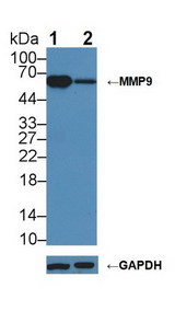 MMP9 / Gelatinase B Antibody - Knockout Varification: Lane 1: Wild-type Jurkat cell lysate; Lane 2: MMP9 knockout Jurkat cell lysate; Predicted MW: 81kDa Observed MW: 65kDa Primary Ab: 1µg/ml Rabbit Anti-Mouse MMP9 Antibody Second Ab: 0.2µg/mL HRP-Linked Caprine Anti-Rabbit IgG Polyclonal Antibody