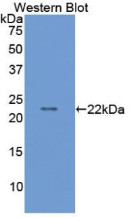 MMP9 / Gelatinase B Antibody - Western blot of recombinant MMP9 / Gelatinase B.