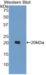 MMP9 / Gelatinase B Antibody - Western blot of recombinant MMP9 / Gelatinase B.  This image was taken for the unconjugated form of this product. Other forms have not been tested.