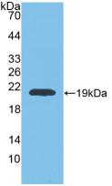 MMP9 / Gelatinase B Antibody - Western Blot; Sample: Recombinant MMP9, Rat.
