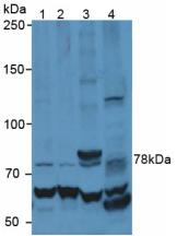 MMP9 / Gelatinase B Antibody - Western Blot; Sample: Lane1: Human Jurkat Cells; Lane2: Human HepG2 Cells; Lane3: Human Raji Cells; Lane4: Rat Brain Tissue.