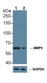 MMP9 / Gelatinase B Antibody - Knockout Varification: Lane 1: Wild-type Jurkat cell lysate; Lane 2: MMP9 knockout Jurkat cell lysate; Predicted MW: 79kDa ; Observed MW: 62kDa; Primary Ab: 2µg/ml Rabbit Anti-Rat MMP9 Antibody; Second Ab: 0.2µg/mL HRP-Linked Caprine Anti-Rabbit IgG Polyclonal Antibody;