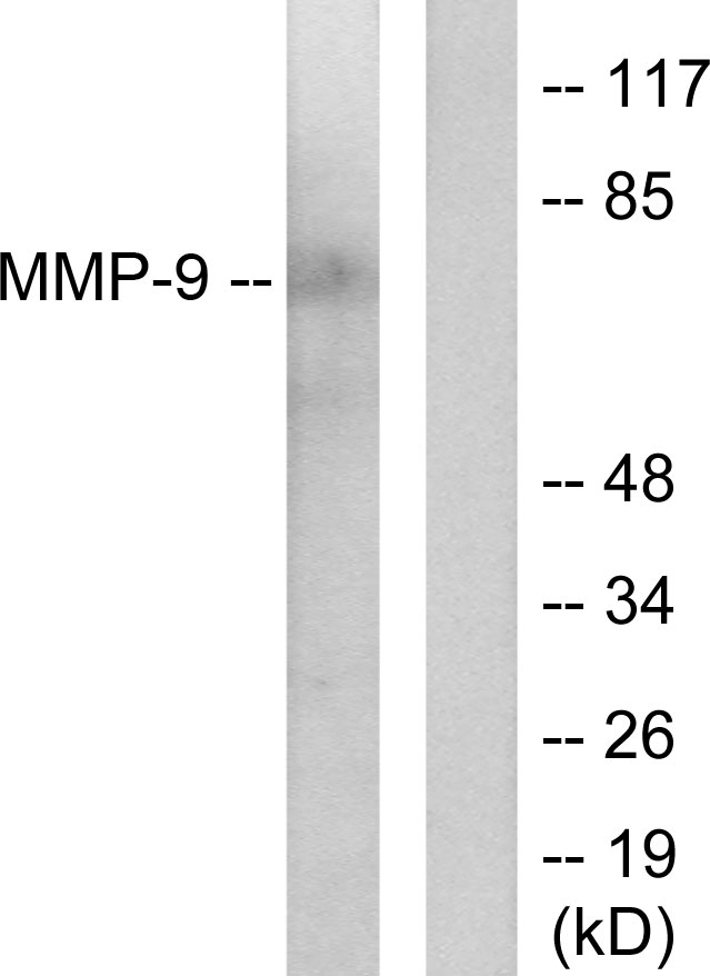 MMP9 / Gelatinase B Antibody - Western blot analysis of lysates from HepG2 cells, using MMP-9 Antibody. The lane on the right is blocked with the synthesized peptide.