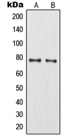 MMP9 / Gelatinase B Antibody - Western blot analysis of MMP9 expression in HT1080 (A); HUVEC (B) whole cell lysates.