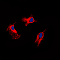 MMP9 / Gelatinase B Antibody - Immunofluorescent analysis of MMP9 staining in HUVEC cells. Formalin-fixed cells were permeabilized with 0.1% Triton X-100 in TBS for 5-10 minutes and blocked with 3% BSA-PBS for 30 minutes at room temperature. Cells were probed with the primary antibody in 3% BSA-PBS and incubated overnight at 4 C in a humidified chamber. Cells were washed with PBST and incubated with a DyLight 594-conjugated secondary antibody (red) in PBS at room temperature in the dark. DAPI was used to stain the cell nuclei (blue).