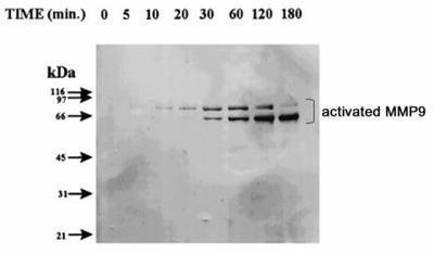 MMP9 / Gelatinase B Antibody - Western Blot: MMP9 Antibody (4A3) - Western blot of activated MMP9 expression in MMP9 proenzyme incubated with trypsin for various times.  This image was taken for the unconjugated form of this product. Other forms have not been tested.