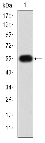 MMP9 / Gelatinase B Antibody - Western blot using MMP9 monoclonal antibody against human MMP9 (AA: 238-465) recombinant protein. (Expected MW is 50.6 kDa)