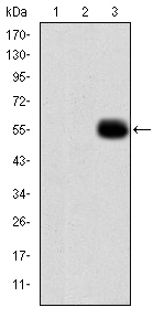 MMP9 / Gelatinase B Antibody - Western blot using MMP9 monoclonal antibody against HEK293 (1), MMP7-hIgGFc transfected HEK293 (2) cell lysate and MMP9 (AA: 238-465)-hIgGFc transfected HEK293 (3) cell lysate.